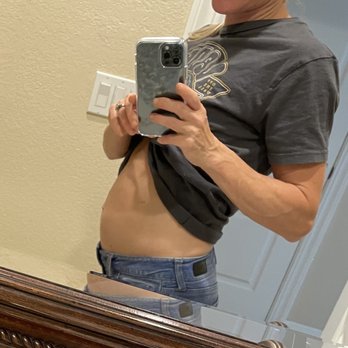 Wellness From Within - Before colonic - Hydrotherapy Near Me - San Diego, California