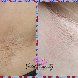 Underarm wax
