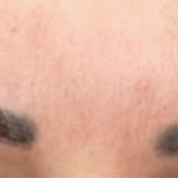 SOI Brow Threading - Uneven and burnt. Very painful!