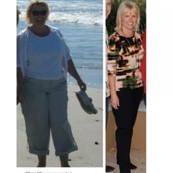 New Results Medical Weight Loss - Kathi's "Before and After" - Wow!
