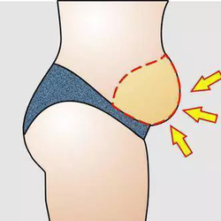 Weight loss injections calgary cost