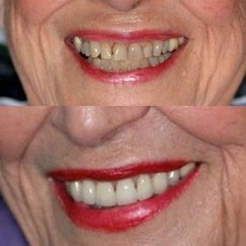Robert G Dernick, DDS - General Dentistry Near Me - The Woodlands, Texas Robert G Dernick, DDS - General Dentistry Near Me - The Woodlands, Texas