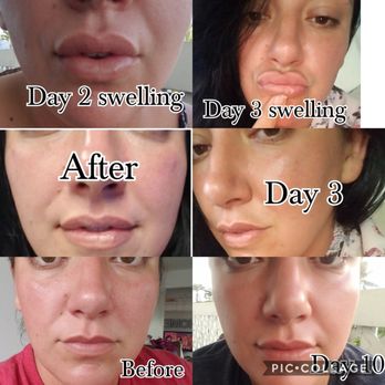 Botox Oahu - Laser Hair Removal Near Me - Honolulu, Hawaii Botox Oahu - Laser Hair Removal Near Me - Honolulu, Hawaii
