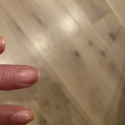 Awful nails Awful nails