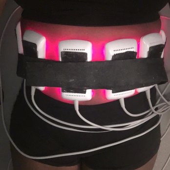 Advanced Spine Joint & Wellness - Lipo Laser paddles it can be relaxing once you get used to the sting of the laser beams - Chiropractors Near Me - Medina, Ohio