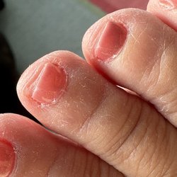 Havana Nails & Spa - Pedicure after I left the salon for nails trimmed crooked cut down to far