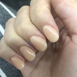 Pinky nail totally off center and gross looking Pinky nail totally off center and gross looking