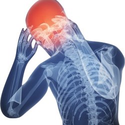 Vermaelen Chiropractic - Chiropractic manipulation, physical medicine modalities and Dry Needling can greatly improve headaches.
