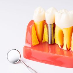 Moraga Dentistry
