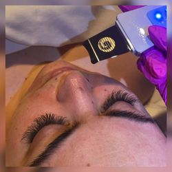 Spa Haus - Ultra sonic exfoliation