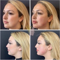 1599 New Scotland Rd, Slingerlands, NY 12159