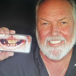 Dental Implants of Spring Hill - Before and after