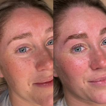 Arch + Skin - The Complete Arch (Brow Lamination + Tint + Mapping + Shaping) - Eyebrow Services Near Me - Dallas, Texas Arch + Skin - The Complete Arch (Brow Lamination + Tint + Mapping + Shaping) - Eyebrow Services Near Me - Dallas, Texas