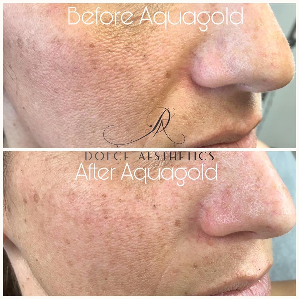 DOLCE AESTHETICS Updated June 2024 7619 Tilghman St, Allentown, Pennsylvania Skin Care