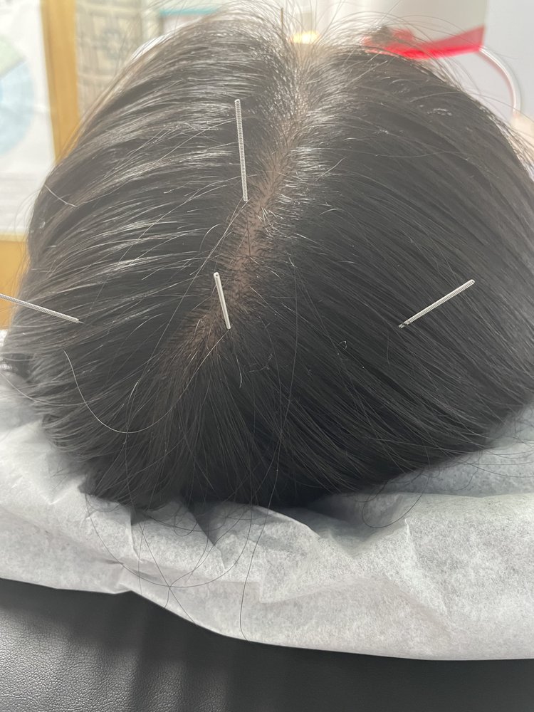 GREEN ACUPUNTURE 27 Photos 1300 W Gonzalez Rd, Oxnard, California