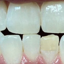 Pine Island Dental - After