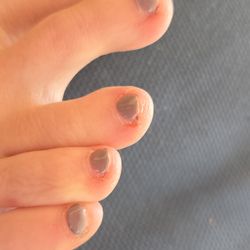 Foxy Nail
