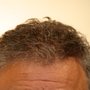 Attis Hair