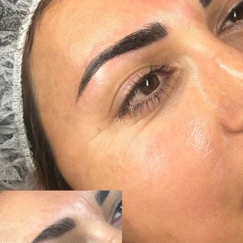 Exquisite Aesthetics - Skin Care Near Me - Redondo Beach, California