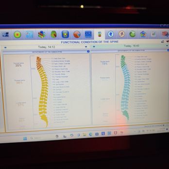 DesertMoon Wellness - Results from my Nero test, before and after 1 day of therapy! - Naturopathic/Holistic Near Me - Las Vegas, Nevada DesertMoon Wellness - Results from my Nero test, before and after 1 day of therapy! - Naturopathic/Holistic Near Me - Las Vegas, Nevada