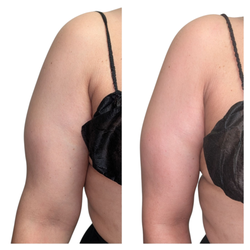 Divine Contours - Before on the left after on the right 1 hour session