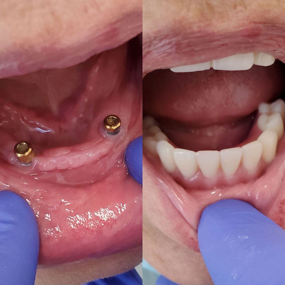 THE DENTAL OFFICE OF CARSON 25 Photos & 89 Reviews 612 E Carson St