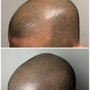 Photo of LV Scalp King