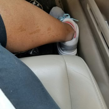 Exquisite Threading - The discoloration almost a month later from the too hot wax - Threading Services Near Me - Greenfield, Wisconsin