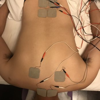 Yupo Health - electrical stimulation - Acupuncture Near Me - New York, New York Yupo Health - electrical stimulation - Acupuncture Near Me - New York, New York