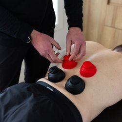 Ascent Health & Sport Therapy - Cupping therapy