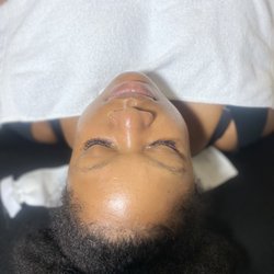 Luvitate Beauty - Freshly done Derma-planning Facial