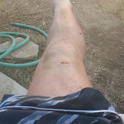Cardiff Limousine & Transportation of Palm Springs - Literally just discharged from the hospital two days before can't get comfortable enough to relax deems me a tweeker