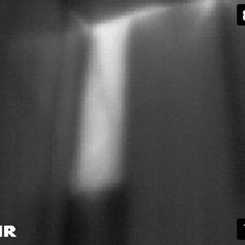 3:23 Inspection Services - Missing insulation picked up with my thermal imaging camera. - Home Inspectors Near Me 3:23 Inspection Services - Missing insulation picked up with my thermal imaging camera. - Home Inspectors Near Me