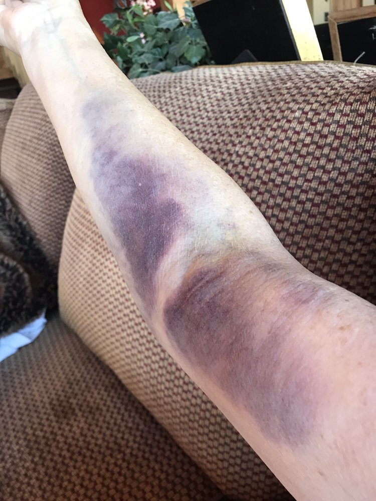 PANORAMA ORTHOPEDICS & SPINE CENTER - GOLDEN - 173 Reviews ...