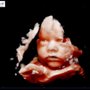 Photo of Peek-A-Boo 3D/4D Ultrasound and Baby Boutique
