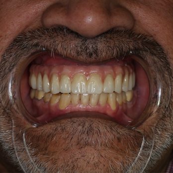 Baja Oral Center - Cosmetic Dentists Near Me - Tijuana, BCN Baja Oral Center - Cosmetic Dentists Near Me - Tijuana, BCN