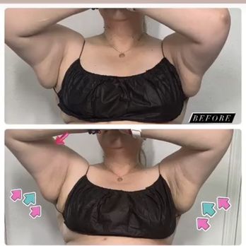 Sculpted Beauty - Body sculpting - Skin Care Near Me - Tracy, California Sculpted Beauty - Body sculpting - Skin Care Near Me - Tracy, California