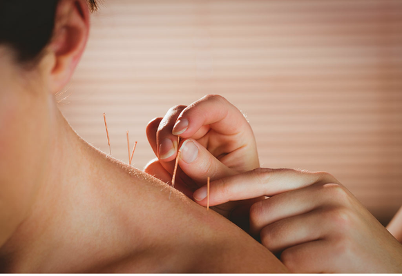 Acupuncture - Acupuncture is the most commonly used modality of Chinese Medicine. It is the use of very thin Sterilized stainless steel needles on specific points along the Acupuncture channels. These channels run throughout the body, if there are any blockages in the flow of Qi and blood, disease and or pain often occurs. Acupuncture helps eliminate blockages and restore balance to the normal flow of “Chi”. Keeping this balance helps prevent the new diseases. The needles are arranged in order to stimulate the body’s own ability to heal itself.