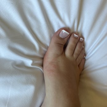 Novotel - More rash from bedding and floor. - Hotels Near Me - Opfikon, ZH