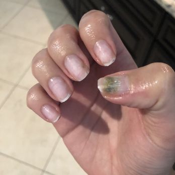 Lotus Nails Day Spa - Nail fungus - Nail Salons Near Me - Saint Cloud, Florida