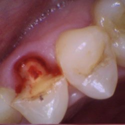 After Hours Dental Care