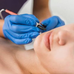 Advanced Electrology Clinic - Electrolysis for lasting confidence.