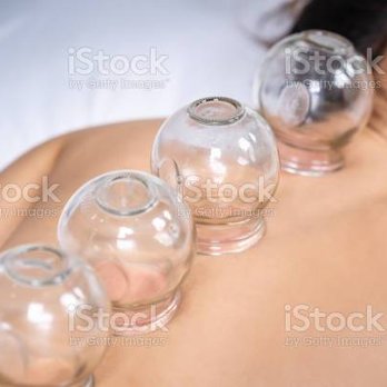 Acupuncture Plus Holistic center - Cupping releases toxins and relaxes the deep muscles. - Acupuncture Near Me - Spring Hill, Florida Acupuncture Plus Holistic center - Cupping releases toxins and relaxes the deep muscles. - Acupuncture Near Me - Spring Hill, Florida