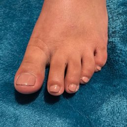 Day 3 after pedicure