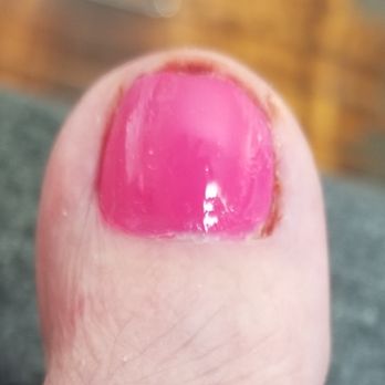 Tic-Tac Nails III - Dried blood after toe was cut and polish applied - Nail Salons Near Me - Plymouth, Michigan Tic-Tac Nails III - Dried blood after toe was cut and polish applied - Nail Salons Near Me - Plymouth, Michigan