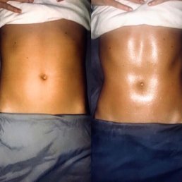 Before and  after the lymph massage! I am grateful!
