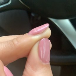 Is it normal???? Is it normal????