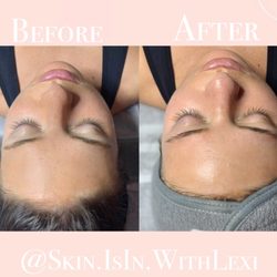 Skin.IsIn.WithLexi - Glow Facial