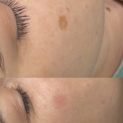 The Skin Bar