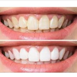 Progressive Dental Center